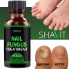 ANTI FUNGAL TREATMENT EXTRA STRENGTH TOENAIL FUNGUS ATHLETES FOOT FUNGI NAIL